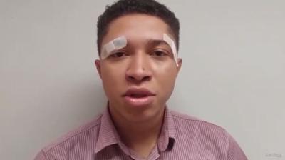 Homem relata agressão após ser confundido com ladrão no MA